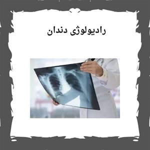 خدمات رادیولوژی دندان، ابزاری حیاتی برای تشخیص و درمان