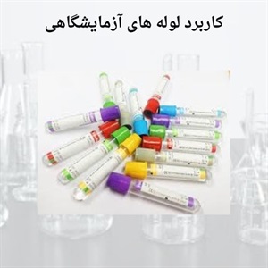 راهنمای کلی خرید لوله آزمایشگاهی